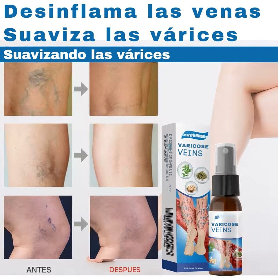 VaricoseVeins Spray™ 2x1 – Alivia el dolor y reduce la apariencia de las várices desde la primera semana