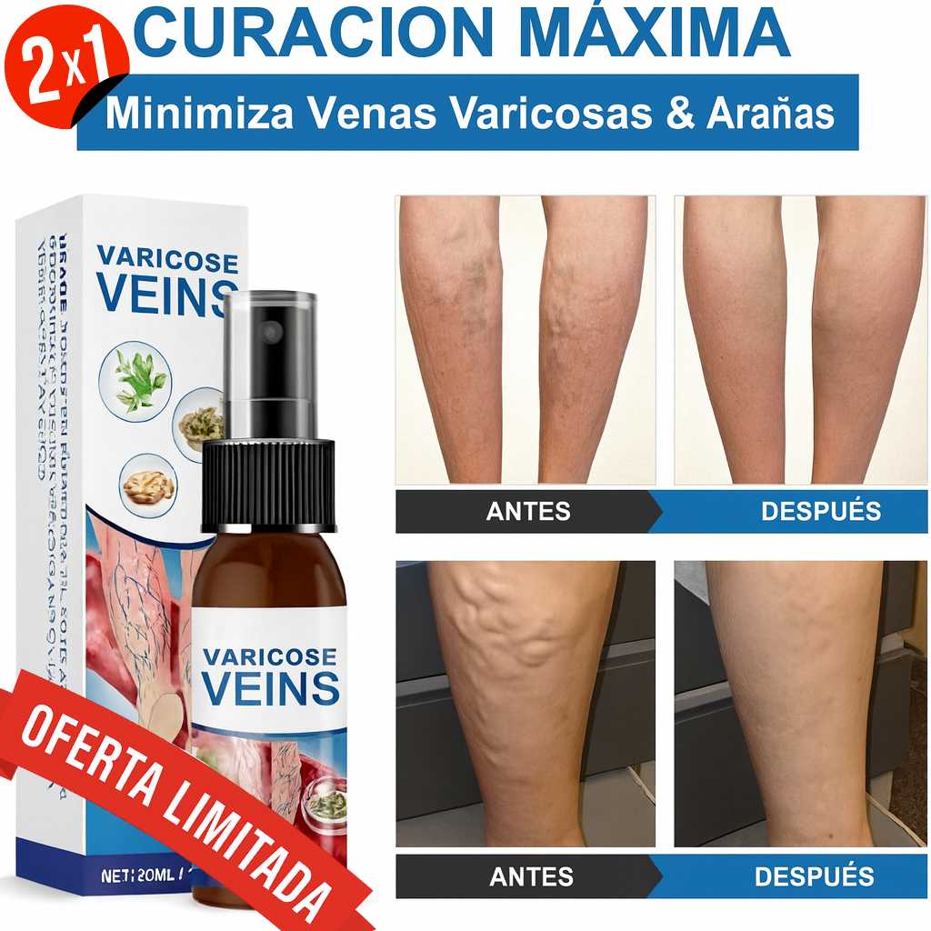 VaricoseVeins Spray™ 2x1 – Alivia el dolor y reduce la apariencia de las várices desde la primera semana